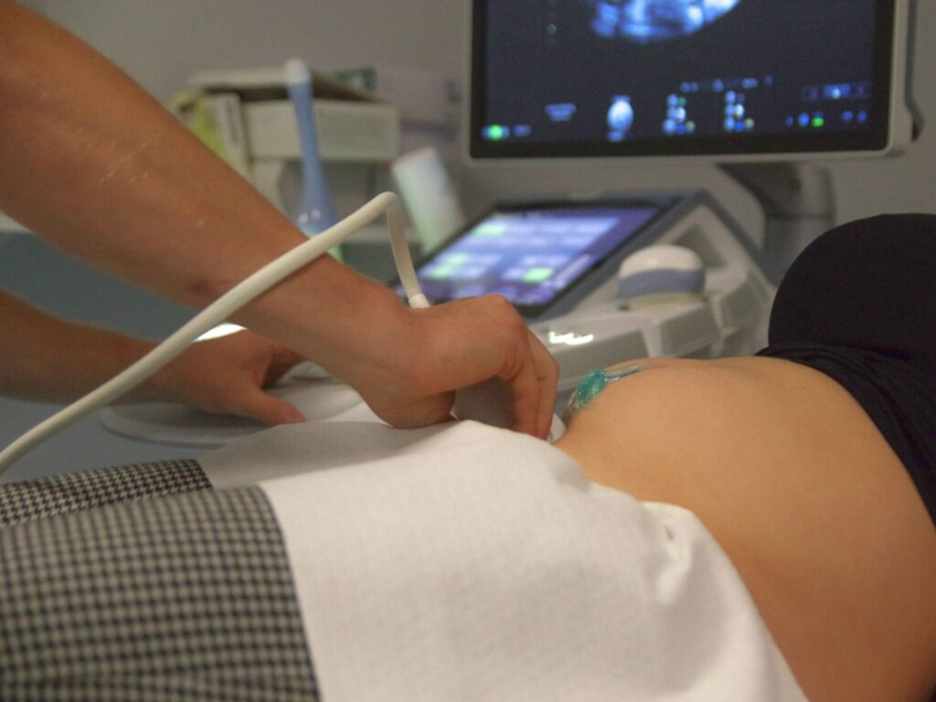 Imagerie médicale - Échographie Imagerie médicale - Échographie