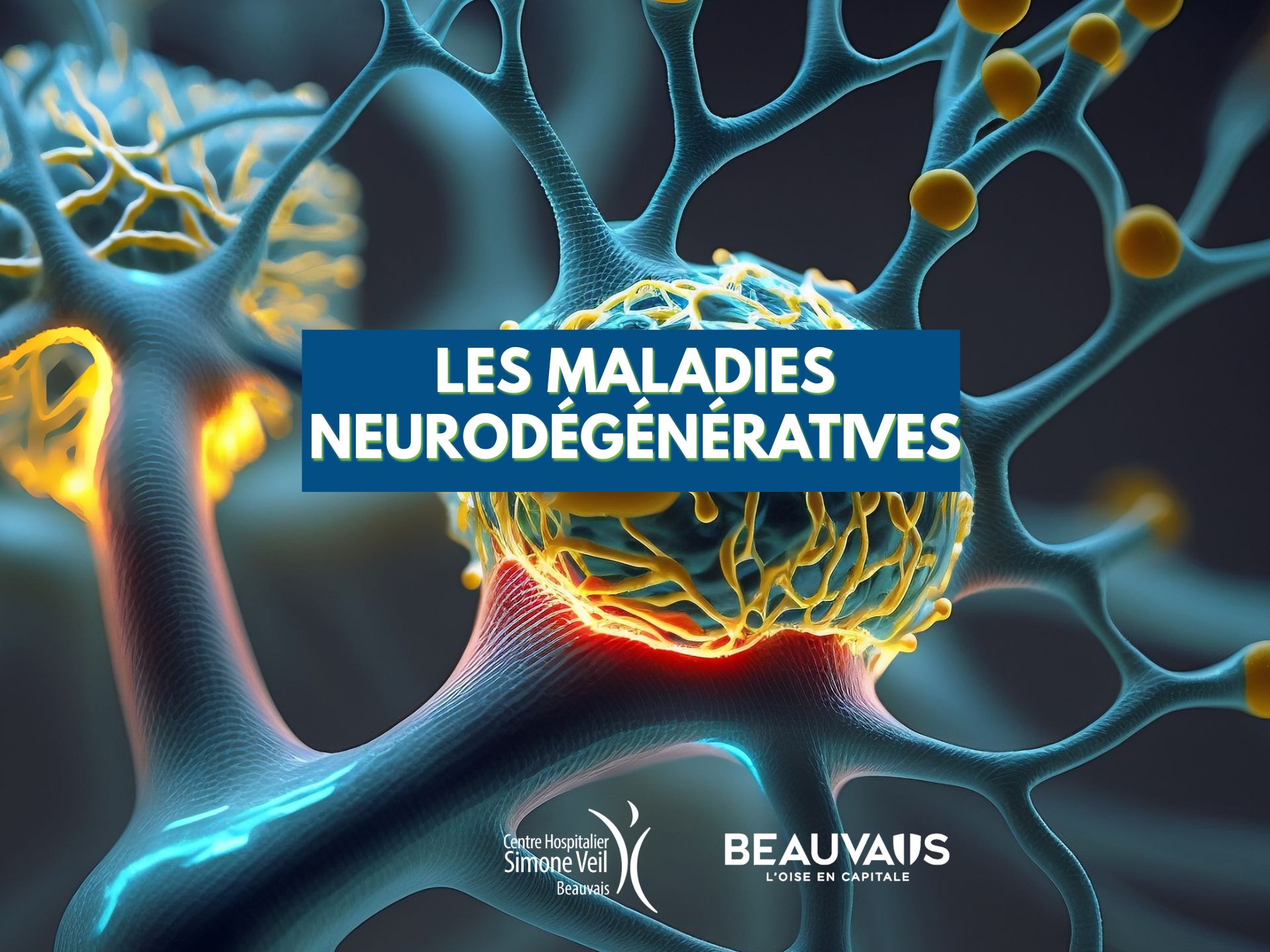 maladies neurodégénératives neurologie neurone cerveau parkinson alzheimer rdv sante (1)