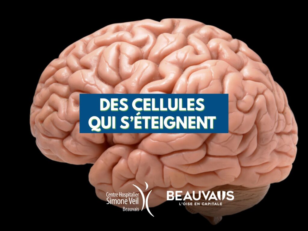maladies neurodégénératives neurologie neurone cerveau parkinson alzheimer rdv sante (3)