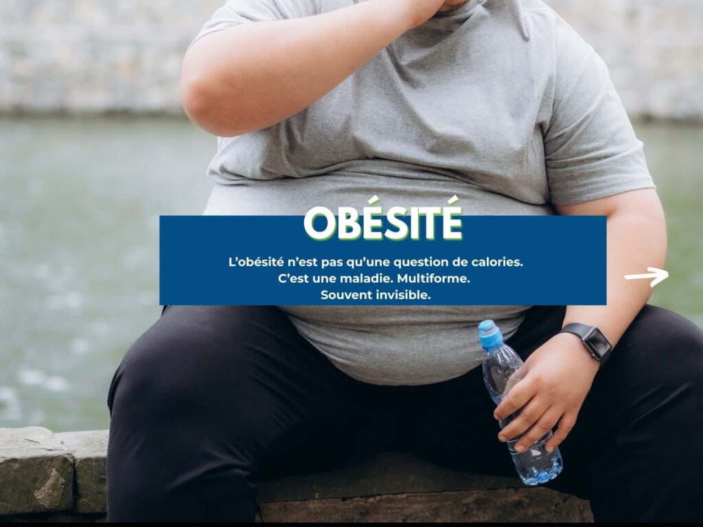 obésité (1)