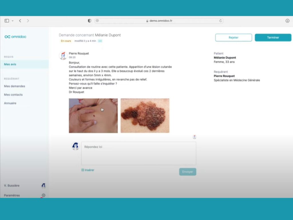omnidoc téléexpertise téléconsultation (3)