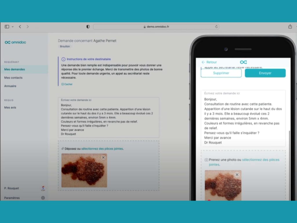 omnidoc téléexpertise téléconsultation télémédecine (6)
